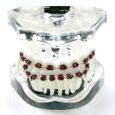 Denture model - OTB4 - GF DENTAL - for orthodontics / training / resin