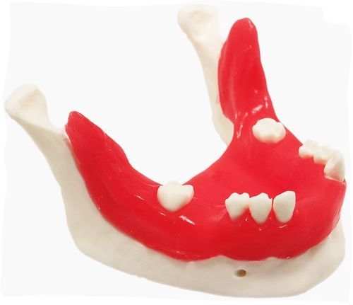 Mandible model - E21/T - GF DENTAL - for implantology / training / red