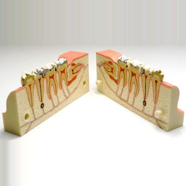 Mandible model - DM21 - GF DENTAL - teeth / dental / temporo-mandibular