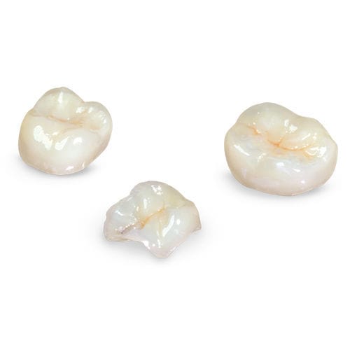 Composite dental material - Glidewell Europe - for dental bridges / for dental crowns / for dental inlays