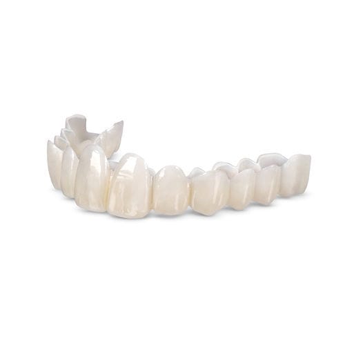 Resin dental prosthesis - Smile Transitions™ - Glidewell Europe - anterior teeth / posterior teeth / removable