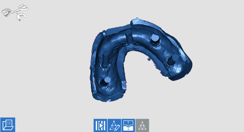 Scan software - OPTORC - Open Tech 3D Srl - acquisition / prescription aid / dental