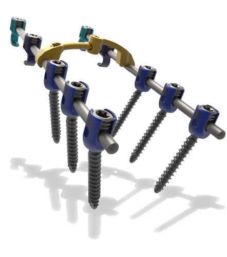 Cervico-thoracic osteosynthesis unit - Blackbird™ - ChoiceSpine - posterior / adult