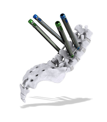 Minimally invasive pedicle screw positioning system - Thunderbolt™ - ChoiceSpine