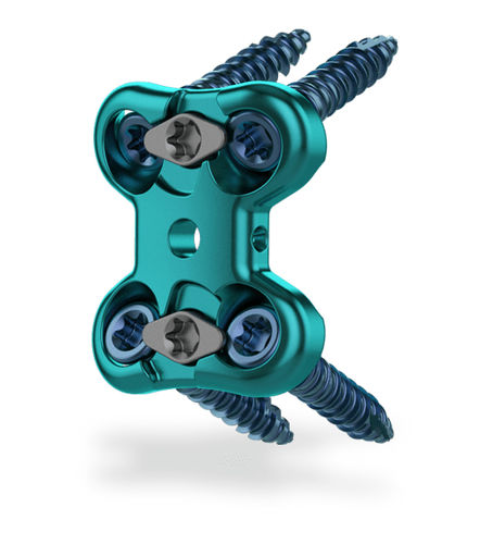 Lumbar arthrodesis plate - Raven®  - ChoiceSpine - 1 level