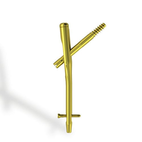 Femoral intramedullary nail - EBA ONE - Citieffe - proximal fixation / titanium