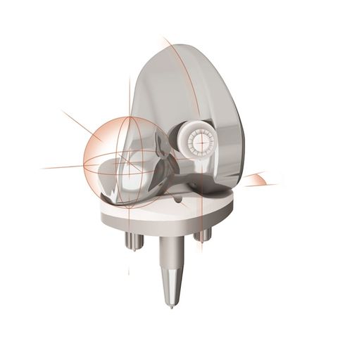 Total knee prosthesis - MRK™ - MatOrtho - fixed-bearing / cemented or non-cemented
