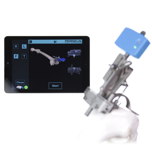 knee surgery resection assessment control system - Orthokey Italia