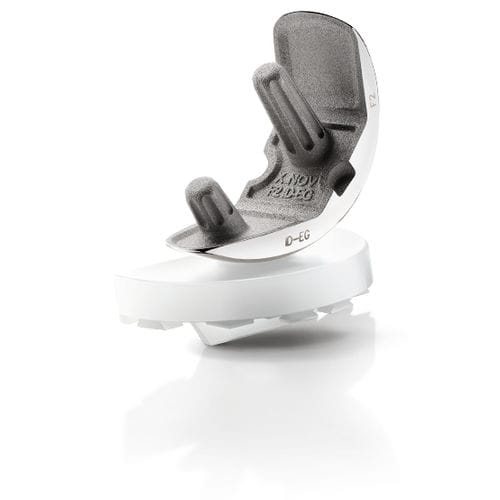 Unicondylar knee prosthesis - KAPS®Full PE - X-NOV Medical Technology - fixed-bearing