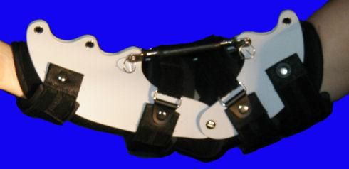 Elbow splint - Turnbuckle - Tiburon Medical Enterprises - L / M / S