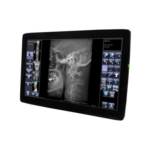 Radiography acquisition system - Primo  - ATS - Applicazione Tecnologie Speciali