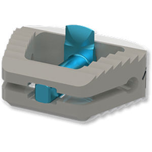 Cervical interbody fusion cage - ARION - Osimplant - anterior / PEEK / expandable