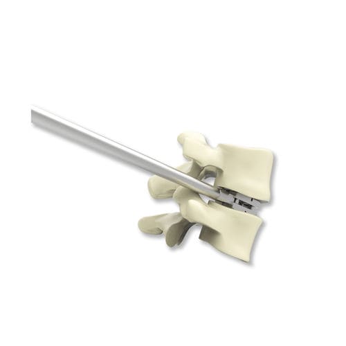 Lumbar interbody fusion cage - ELYON - Osimplant - anterior / titanium / expandable