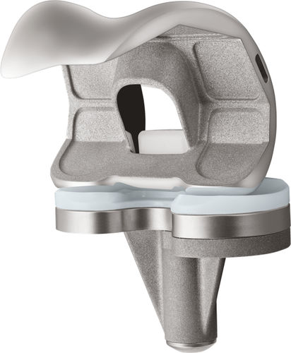 Three-compartment knee prosthesis - U2™ - US Orthopedics - fixed-bearing