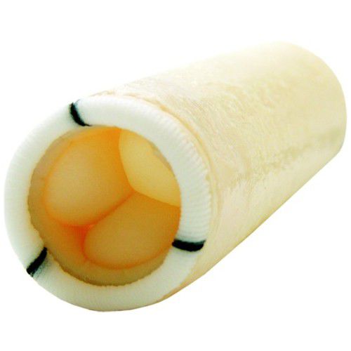 Ascending aorta vascular bioprosthesis - SMOOTH 300 - Braile Biomedica - xenograft / with valve