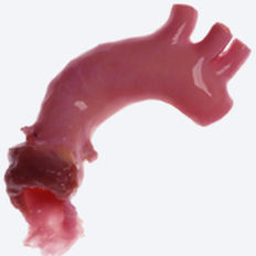 Aorta vascular bioprosthesis - CryoValve® - Cryolife - allograft / with valve