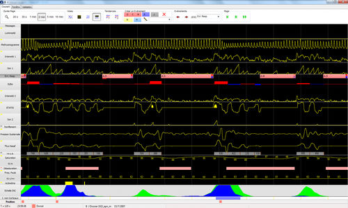 Analysis software - CIDELEC - reporting / visualization / hospital
