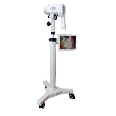 Video colposcope - SLV - 101 HDM - Biomedicinos Technika - trolley-mounted