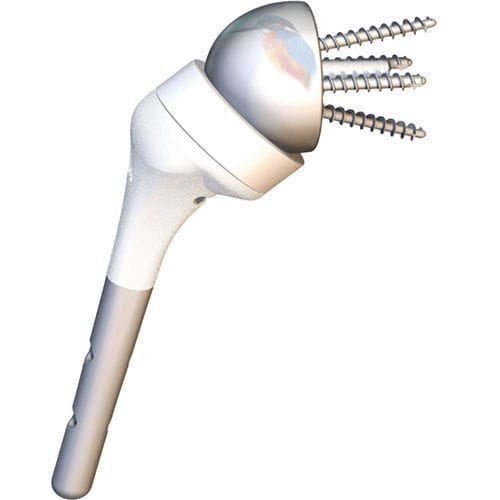 Reverse shoulder prosthesis - HUMELOCK ® - FX Solutions - cementless