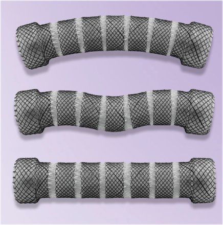 Esophageal stent - ESO-4-20-60-SEG - Creo Medical - silicone / nitinol / self-expanding
