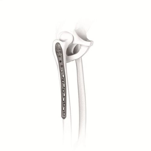 Femur compression plate - 123228 series - Canwell Medical - proximal / locking / titanium