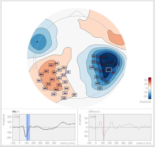 Analysis software - Statistics 2.1 - BESA GmbH - test / import / EEG