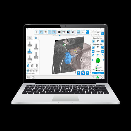 Shoulder prosthesis positioning surgical navigation system - Equinoxe®GPS® - Exactech - AR / optical