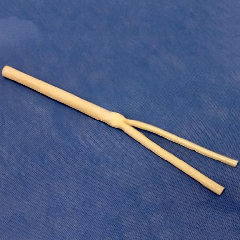 Carotid artery model - 3-Dmed - vein / common carotid artery / vascular surgery