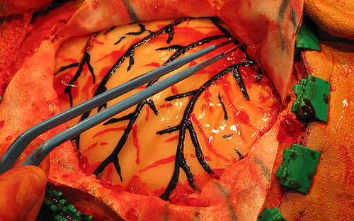 Craniotomy patient simulator - Operative Experience Inc. - surgery