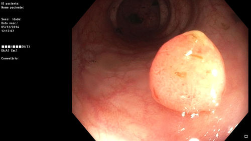 Visualization software - Perceive3D, S.A. - modeling / universal / surgical