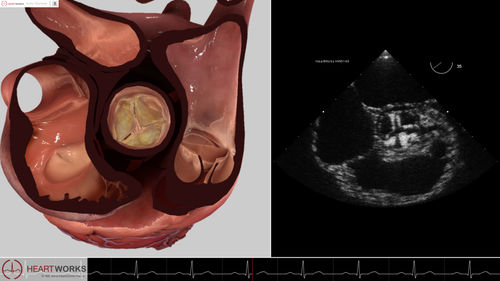 Echocardiography software module - Pathology Module 2 - Inventive Medical Limited - evaluation