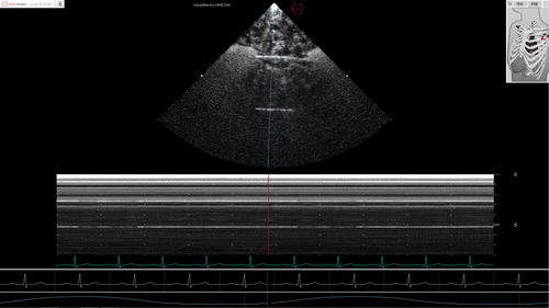 Echocardiography software module - Pathology Module 6 - Inventive Medical Limited - evaluation