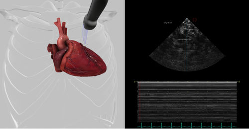 Echocardiography software module - Pathology Module 7 - Inventive Medical Limited - evaluation