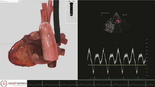 Echocardiography software module - Pathology Module 3 - Inventive Medical Limited - evaluation