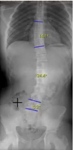 radiography software - Medecom