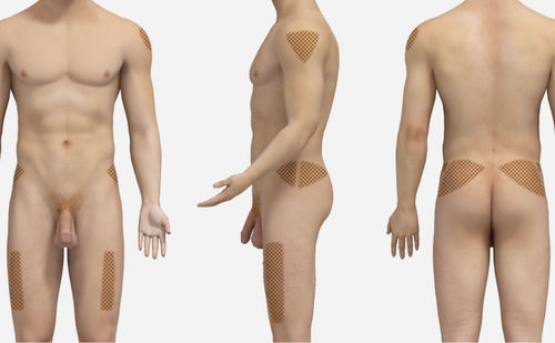 Intramuscular injection simulation module - SIMTICS - for general care / web-based