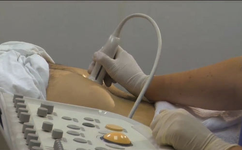 Ultrasound imaging simulation module - SIMTICS - for endoscopic retrograde cholangiopancreatography / anatomy / web-based