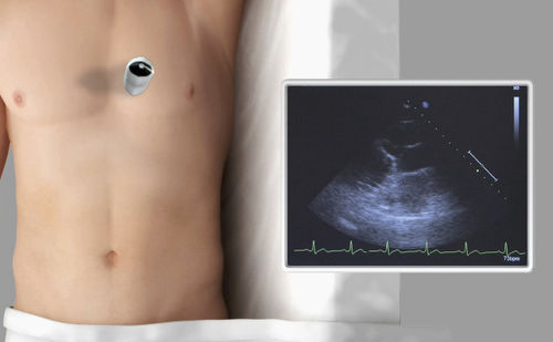Echocardiography simulation module - SIMTICS - anatomy / web-based