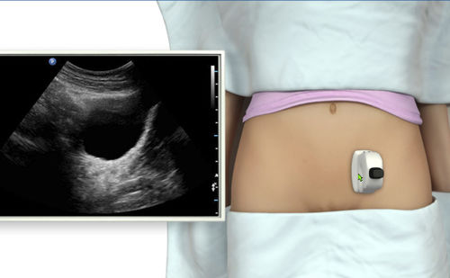 Ultrasound imaging simulation module - SIMTICS - anatomy / for obstetric care / pregnancy