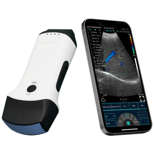 Hand-held ultrasound system - SIFULTRAS-5.61 - SIFSOF - for multipurpose ultrasound imaging / color doppler / B/W