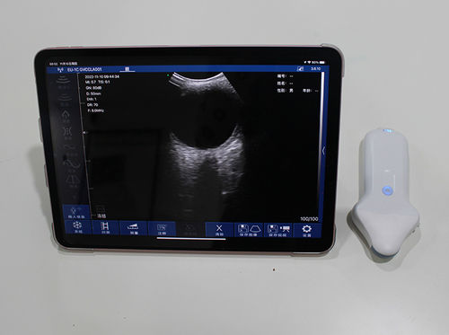 Portable ultrasound system - SIFULTRAS-5.04 - SIFSOF - for skin ultrasound imaging / B/W / all-in-one probe