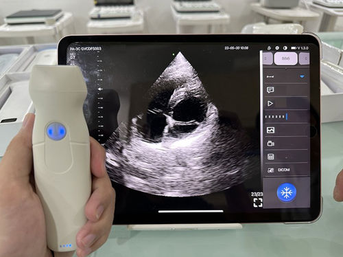 Hand-held ultrasound system - SIFULTRAS-2.33 - SIFSOF - for multipurpose ultrasound imaging / B/W / all-in-one probe