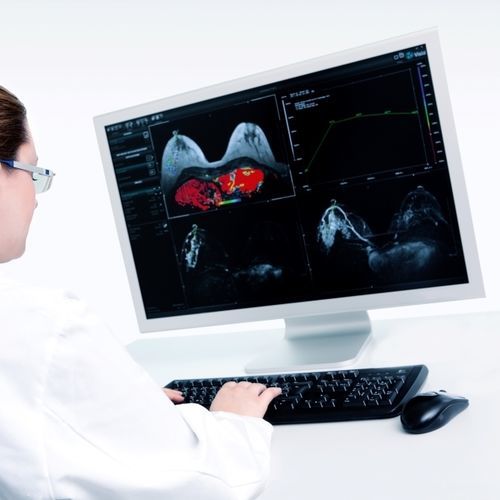 Analysis software - VAREX Imaging - visualization / screening / medical
