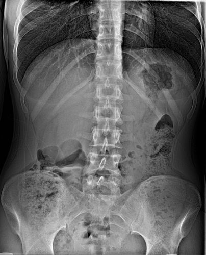 Image analysis software - Nexus DR  - VAREX Imaging - acquisition / data processing / medical