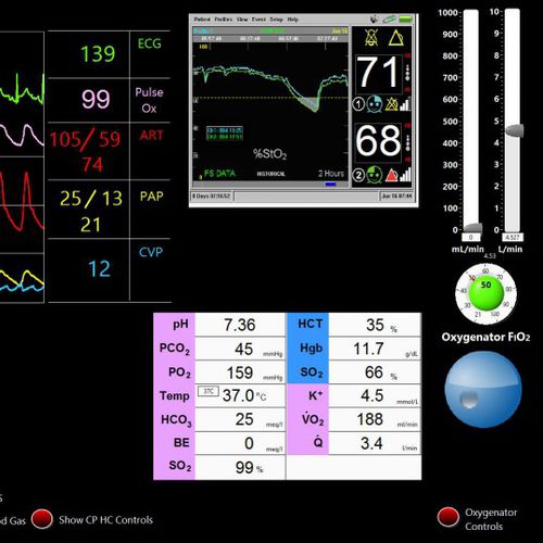 Cardiopulmonary care simulator - Biomed Simulation Inc. - cardiac surgery / monitor / computer-assisted