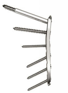Femur compression plate - Aconda  - Spinamer Health Products - trochanter / proximal / locking