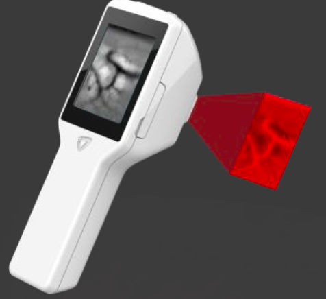 Infrared vein finder - Veinus Pro - InfraEyes - venipuncture