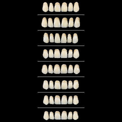 Acrylic dental prosthesis - Almamiss Upper  - Wiedent - anterior teeth