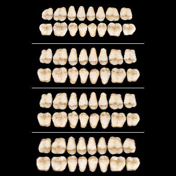 Acrylic dental prosthesis - Almamiss   - Wiedent - posterior teeth