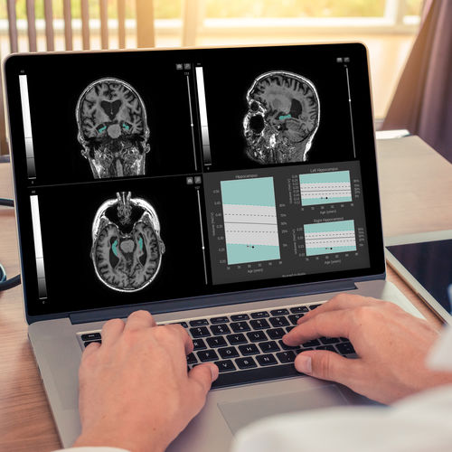 Image analysis software - QyScore® - qynapse - reporting / visualization / diagnostic